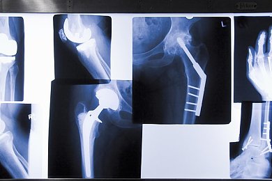 王者小乔流眼泪翻白眼照片：网络热议：游戏角色表情引发审美与价值观的思考，小乔表情走红背后的文化现象解析